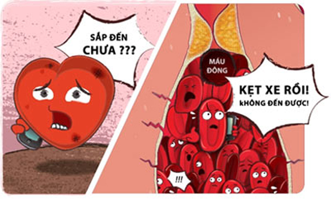 BỆNH ĐÔNG MÁU VÀ NHỮNG ĐIỀU CẦN BIẾT